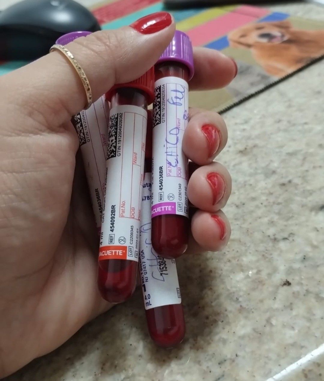 Exames Laboratoriais a domicílio — Dra. Grazy Home Care